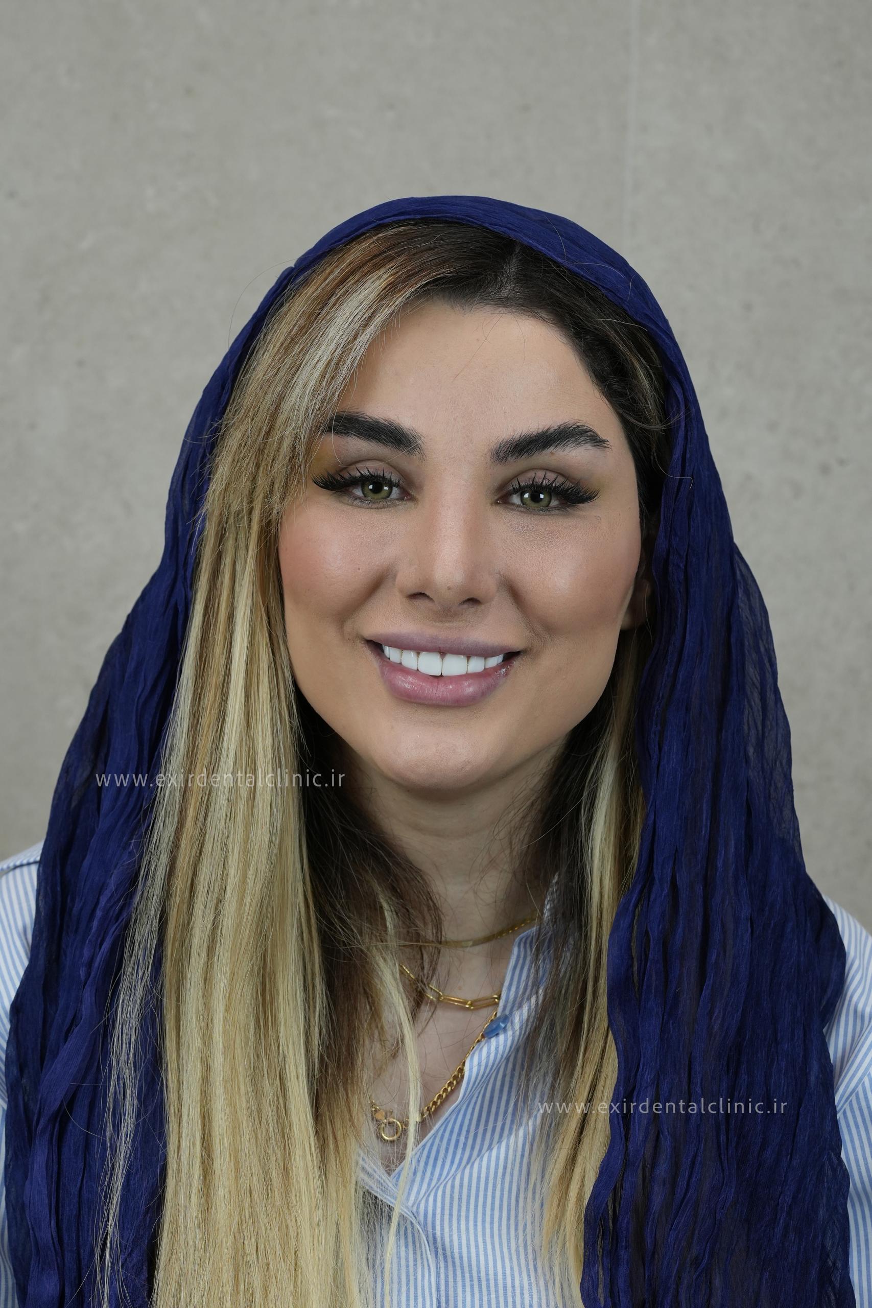 نمای لبخند در چهره مراجعه‌کننده