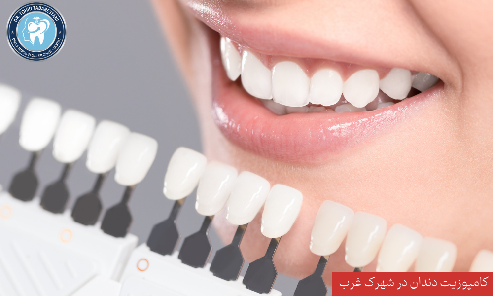 مزایای ونیر کامپوزیت و اصلاح طرح لبخند در شهرک غرب