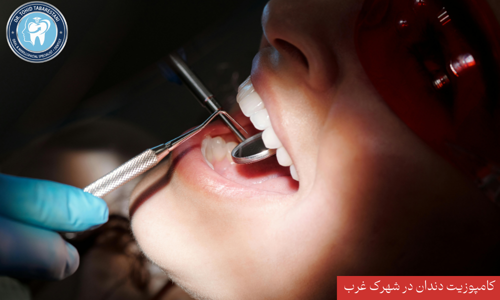 تفاوت ونیر کامپوزیت و لمینت دندان - دکتر طبرستانی