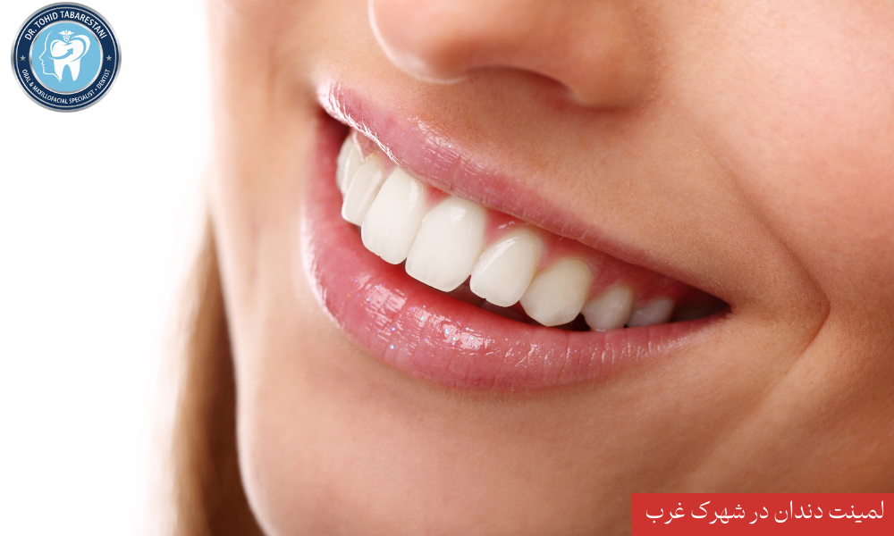 لمینت سرامیکی دندان و اصلاح طرح لبخند در شهرک غرب