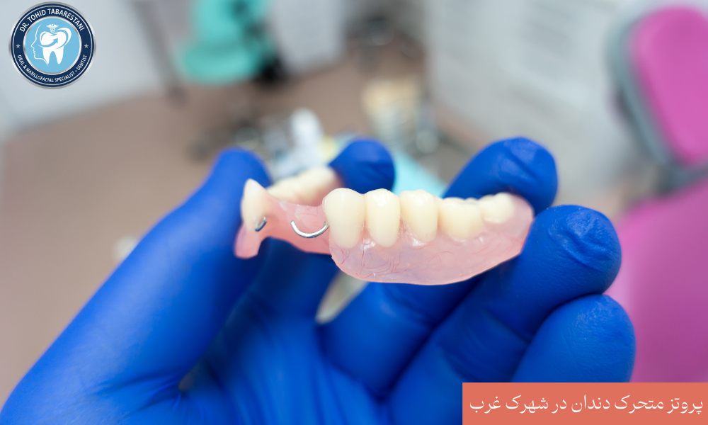 پروتز متحرک دندان چیست و چه کاربردی دارد