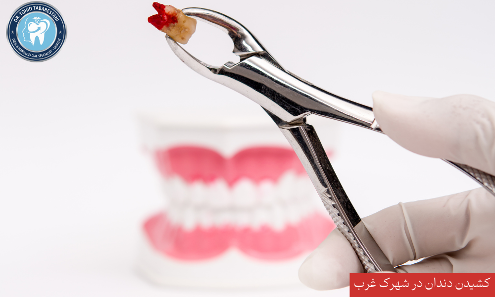 کشیدن دندان بدون درد و با بی حسی کامل در شهرک غرب