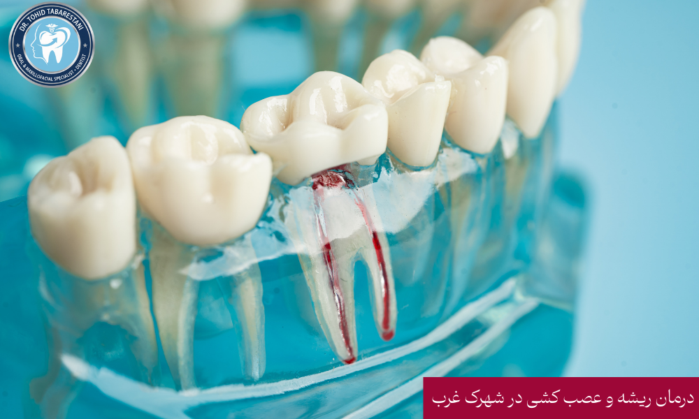 تجهیزات مدرن اندودانتیکس و درمان ریشه در کلینیک اکسیر