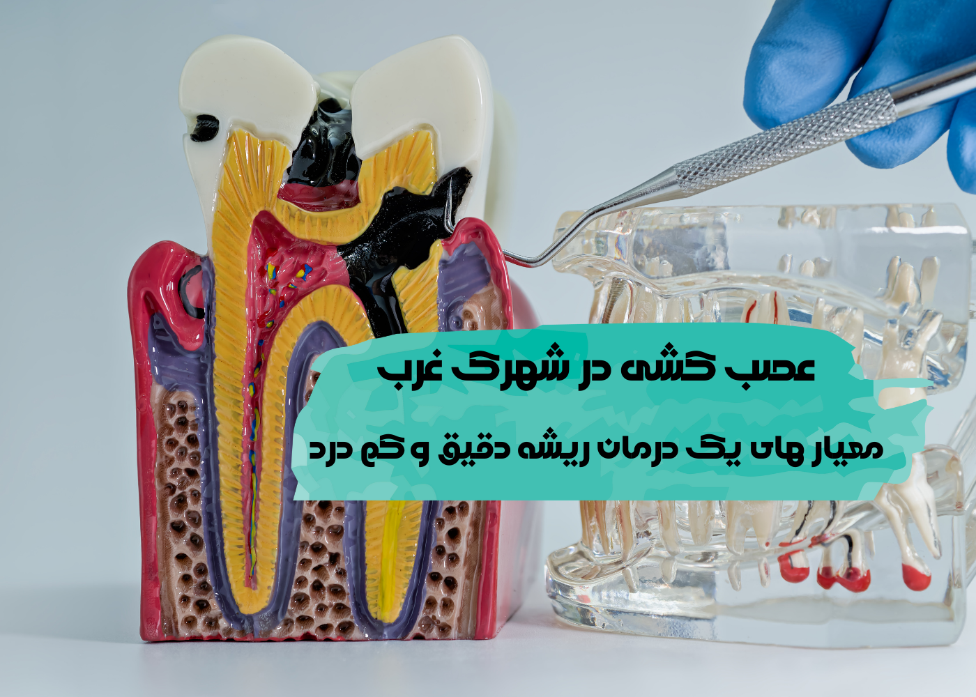 عصب کشی در شهرک غرب