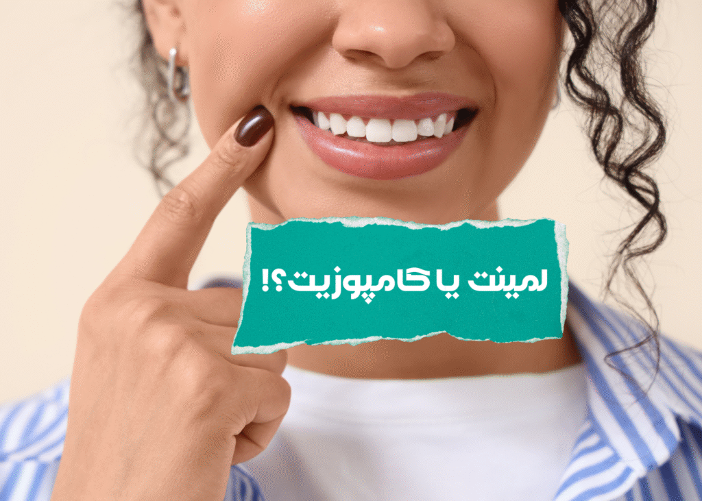 تفاوت کامپوزیت و لمینت در چیست؟!
