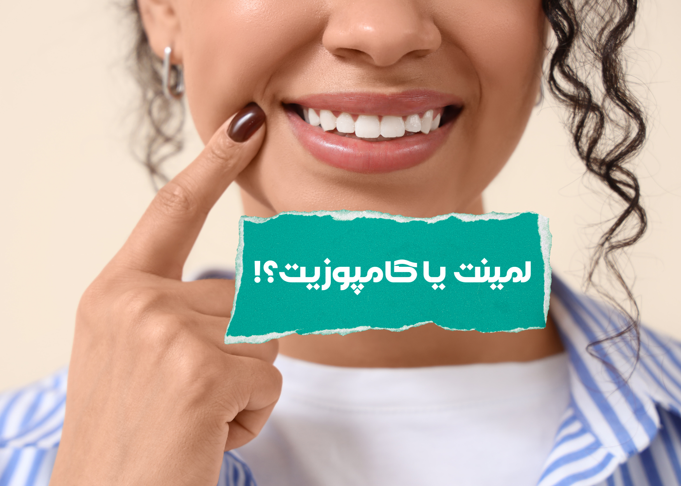 تفاوت کامپوزیت و لمینت در چیست؟!