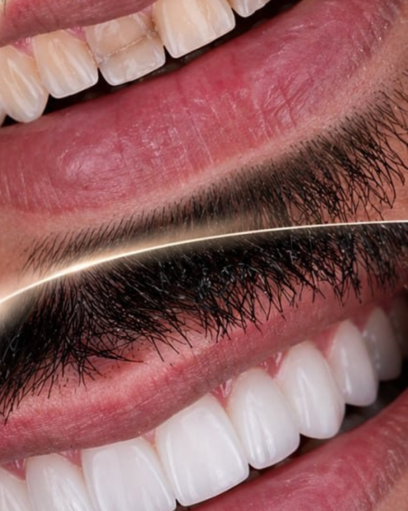 نمونه کار کامپوزیت 7