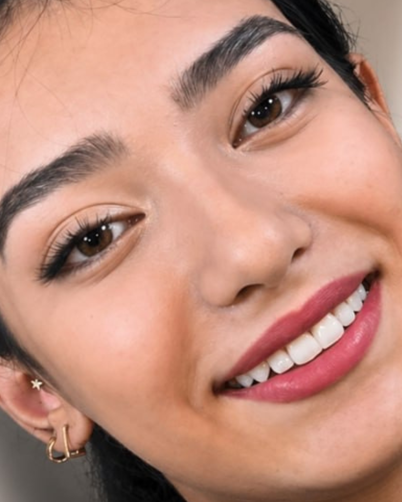 نمونه کار کامپوزیت 8